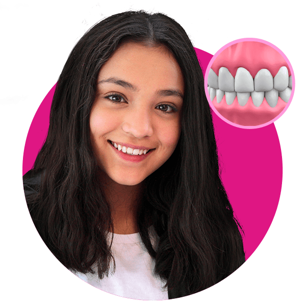 Checkup Dental en Sonrisas Mexicanas